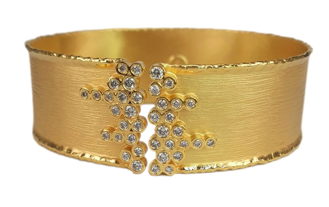 The Retrograde Cuff